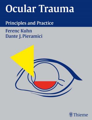 Book cover of Ocular Trauma