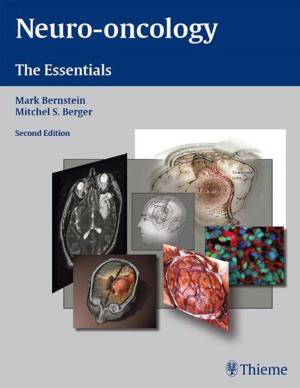Cover of the book Neuro-Oncology: The Essentials by Albert L. Menner