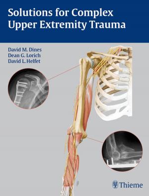 Cover of the book Solutions for Complex Upper Extremity Trauma by Mahmut Gazi Yasargil