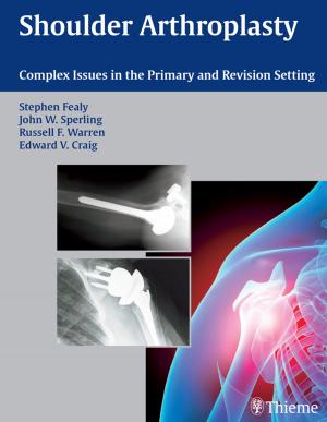 Cover of the book Shoulder Arthroplasty by Diethelm Wallwiener