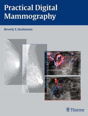 Cover of the book Practical Digital Mammography by Foad Nahai