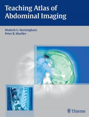 Cover of the book Teaching Atlas of Abdominal Imaging by Eugene Yu, Nasir Jaffer, TaeBong Chung