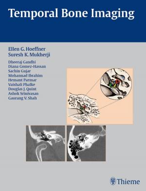 Cover of the book Temporal Bone Imaging by Michael Schuenke, Erik Schulte, Udo Schumacher