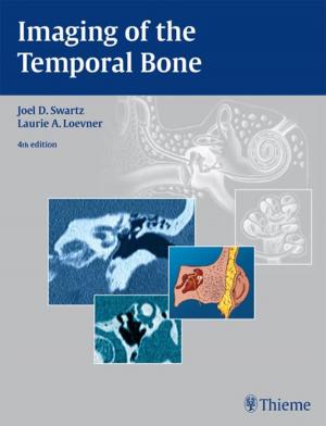 Cover of the book Imaging of the Temporal Bone by William J. Fishkind