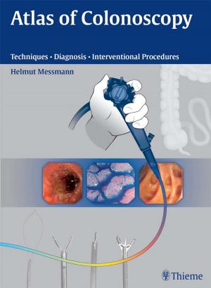 Cover of the book Atlas of Colonoscopy by Michael Schuenke, Erik Schulte, Udo Schumacher