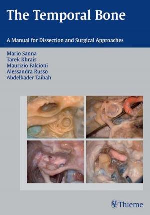 bigCover of the book Temporal Bone by 