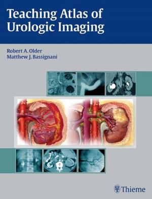 Cover of the book Teaching Atlas of Urologic Imaging by Uwe Fischer, Friedemann Baum