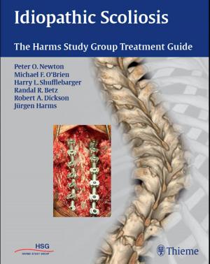 Cover of the book Idiopathic Scoliosis by Michael Schuenke, Erik Schulte, Udo Schumacher
