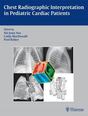 Cover of the book Chest Radiographic Interpretation in Pediatric Cardiac Patients by Tim Meyer, Ian Beasley, Zoran Bahtijarevic