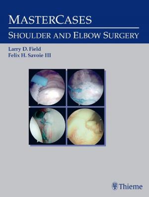 Cover of the book MasterCases in Shoulder and Elbow Surgery by Philipp Lobenhoffer, Ronald J. van Heerwaarden, Alex E. Staubli