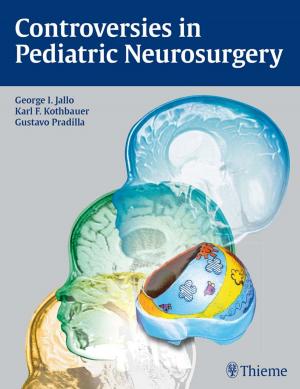 Cover of the book Controversies in Pediatric Neurosurgery by Louis E. Probst, John F. Doane