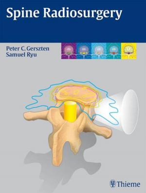 Cover of the book Spine Radiosurgery by Tony R. Bull, John S. Almeyda