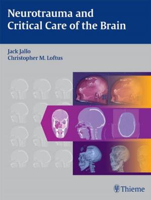 Cover of the book Neurotrauma and Critical Care of the Brain by Francoise Wilhelmi de Toledo, Hubert Hohler