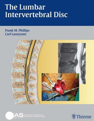 Cover of the book Lumbar Intervertebral Disc by Antje Hueter-Becker, Mechthild Doelken