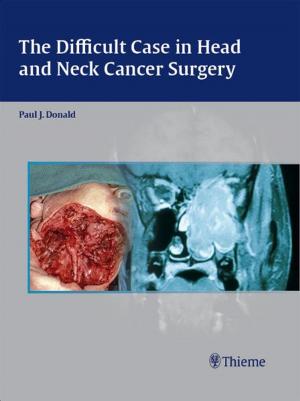 bigCover of the book Difficult Case in Head and Neck Cancer Surgery by 