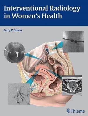 Cover of the book Interventional Radiology in Women's Health by Michael B. Zimmermann