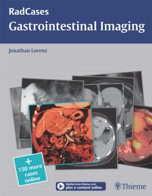 Cover of the book Gastrointestinal Imaging by 