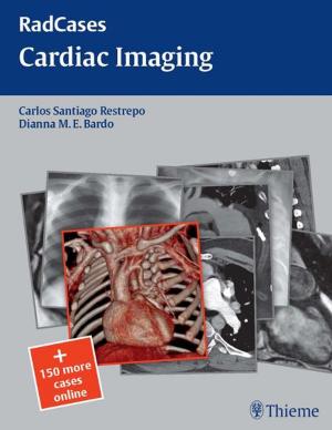Cover of the book Cardiac Imaging by Beverly Hashimoto