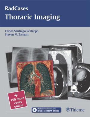 Cover of the book Thoracic Imaging by Jaime Tisnado, Philip C. Pieters, Matthew A. Mauro