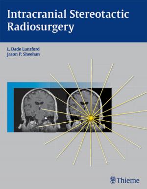 Cover of the book Intracranial Stereotactic Radiosurgery by Rod Rohrich, Jamil Ahmad
