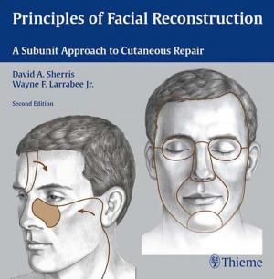 Cover of the book Principles of Facial Reconstruction by Stephen Russell