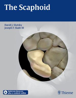 Cover of the book Scaphoid by Harald Stossier