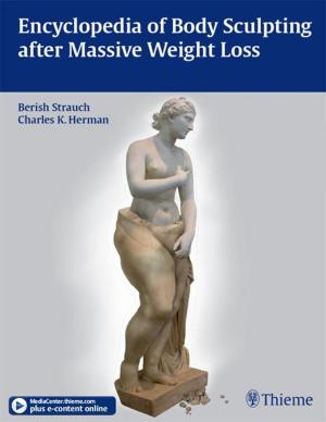 Cover of the book Encyclopedia of Body Sculpting after Massive Weight Loss by 