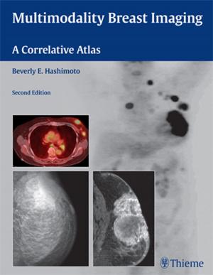 Cover of the book Multimodality Breast Imaging by Andrea Baur-Melnyk, Maximilian F. Reiser