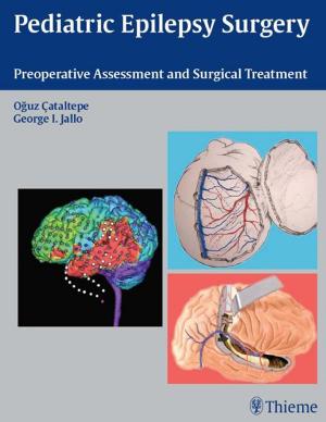 Cover of the book Pediatric Epilepsy Surgery by Todd J. Albert, Alexander R. Vaccaro