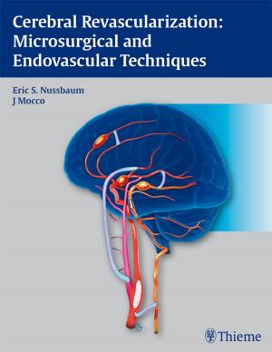 Cover of the book Cerebral Revascularization: Microsurgical and Endovascular Techniques by Markus K. Heinemann