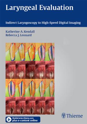 Cover of the book Laryngeal Evaluation by Guillermo Loda