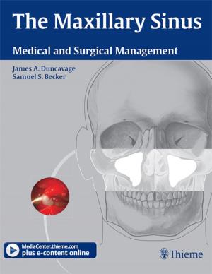 Cover of the book Maxillary Sinus by Malte Erik Wigand