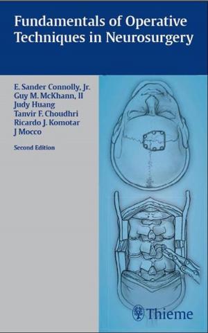 Cover of the book Fundamentals of Operative Techniques in Neurosurgery by Karin Wieben, Bernd Falkenberg