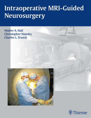 Cover of the book Intraoperative MRI-Guided Neurosurgery by Erich Burghardt, Hellmuth Pickel