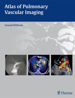 Cover of the book Atlas of Pulmonary Vascular Imaging by Peter Fischer