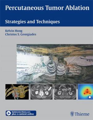 Cover of the book Percutaneous Tumor Ablation by Andrew Blitzer, Mitchell F. Brin, Lorraine Olson Ramig