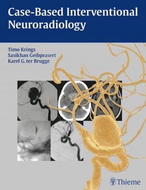 Cover of the book Case-Based Interventional Neuroradiology by Shailendra Chopra