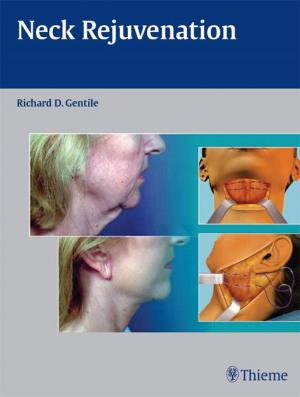 Cover of the book Neck Rejuvenation by Michael Sabel