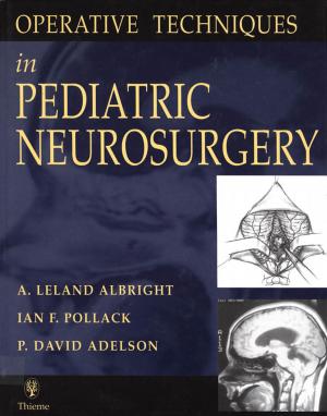 Cover of the book Operative Techniques in Pediatric Neurosurgery by Beverly Hashimoto