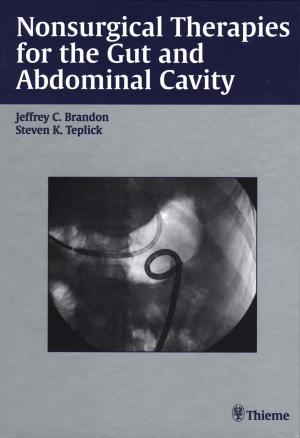Cover of the book Nonsurgical Therapies for the Gut and Abdominal Cavity by 