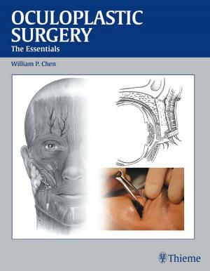 Cover of the book Oculoplastic Surgery by Gerd R. Burmester, Antonio Pezzutto