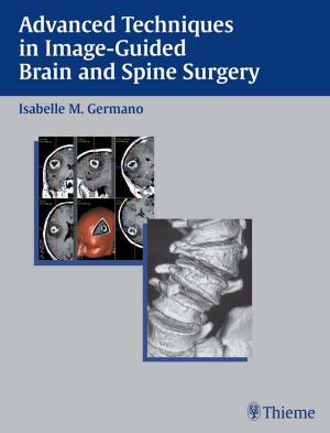 Cover of the book Advanced Techniques in Image-Guided Brain and Spine Surgery by Chun Kim, Katherine Zukotynski