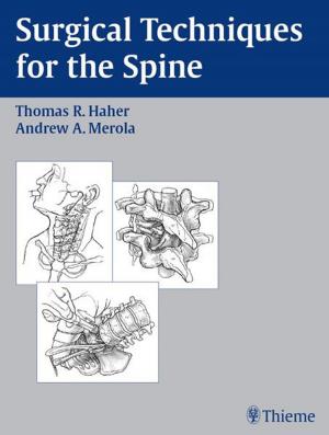 Cover of the book Surgical Techniques for the Spine by Hans Behrbohm, Jacqueline Eichhorn-Sens, Joachim Ulrich Quetz