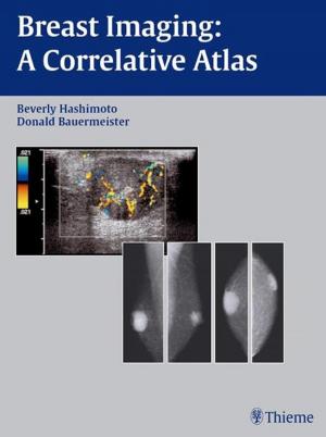 Cover of the book Breast Imaging by Victor G. Lacombe, Theda C. Kontis