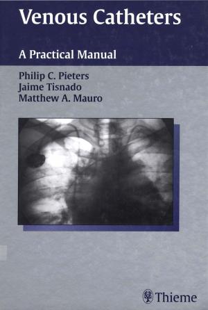 Book cover of Venous Catheters