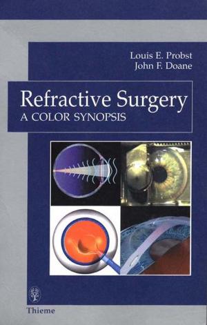 Cover of the book Refractive Surgery: A Color Synopsis by John A. McCurdy, Samuel M. Lam