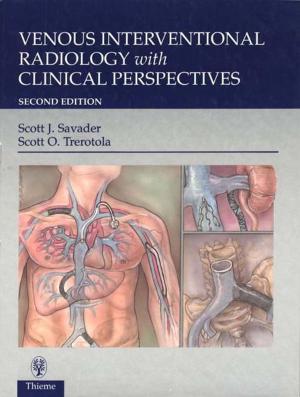 Cover of the book Venous Interventional Radiology With Clinical Perspectives by Anne M. Gilroy, Brian R. MacPherson, Michael Schuenke