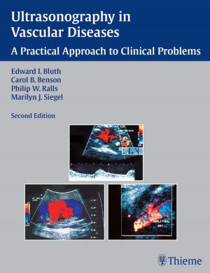 Cover of the book Ultrasonography in Vascular Diseases by Malte Erik Wigand