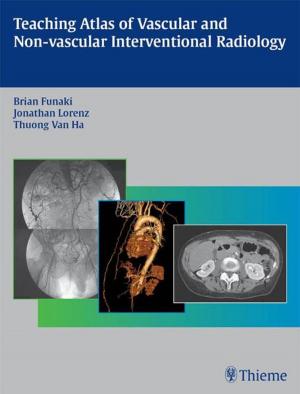 Book cover of Teaching Atlas of Vascular and Non-vascular Interventional Radiology