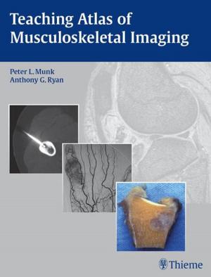 Cover of the book Teaching Atlas of Musculoskeletal Imaging by Ulrich Peitz, Ren Mantke